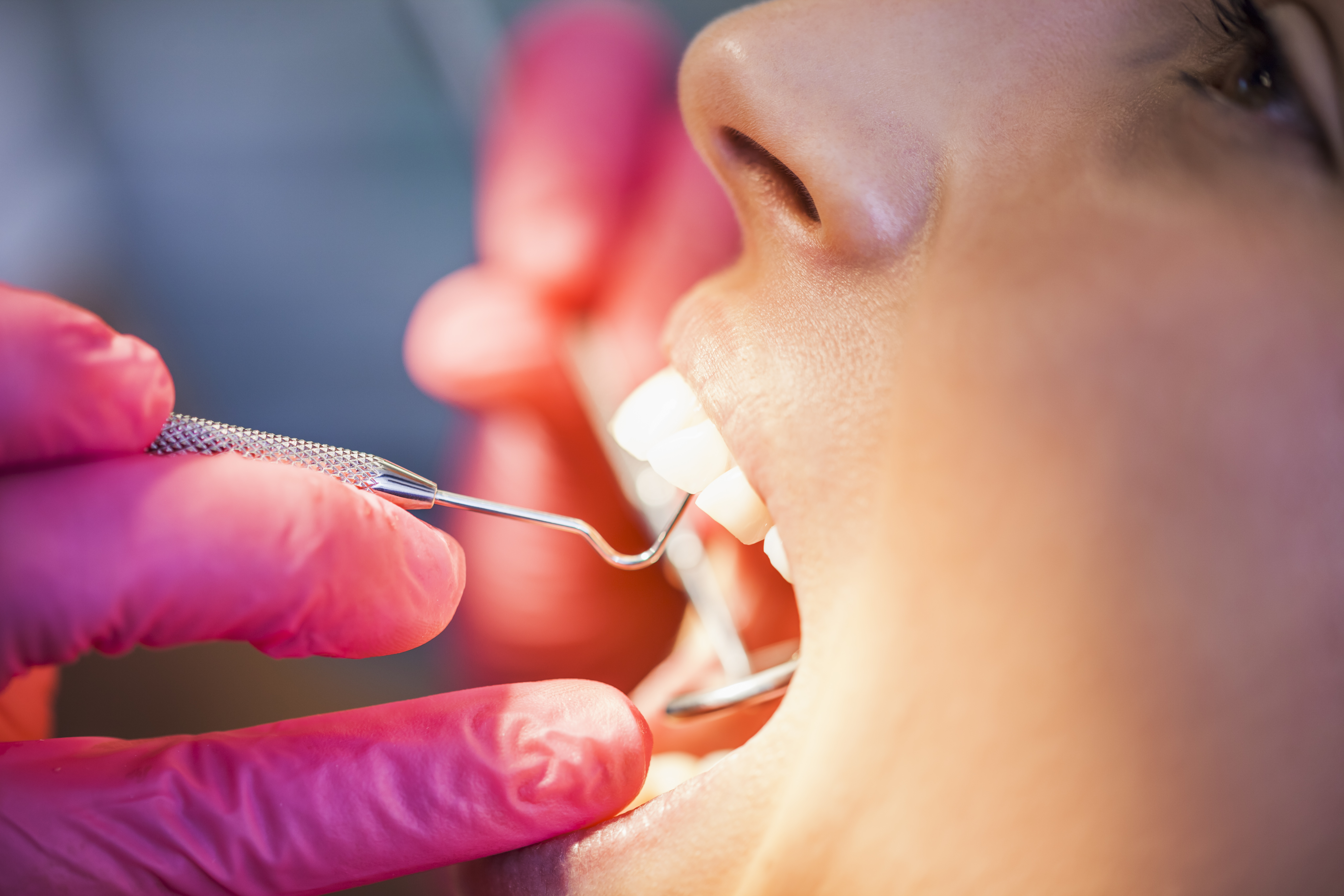 Periodoncia